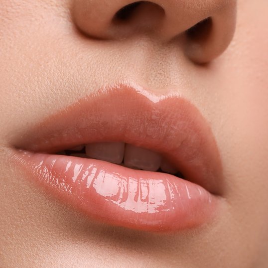 Mulher com gloss com ácido hialurônico nos lábios.